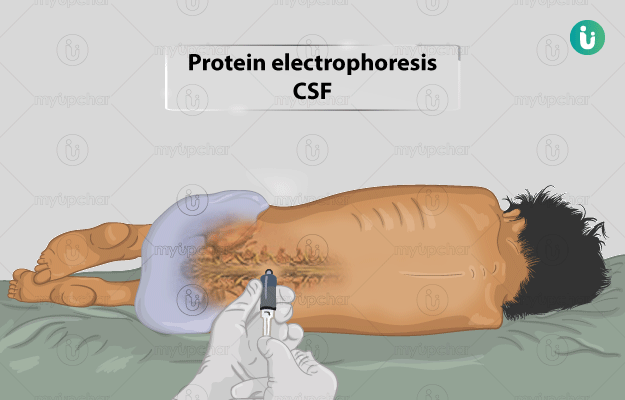 Protein Electrophoresis - [Csf, Serum]